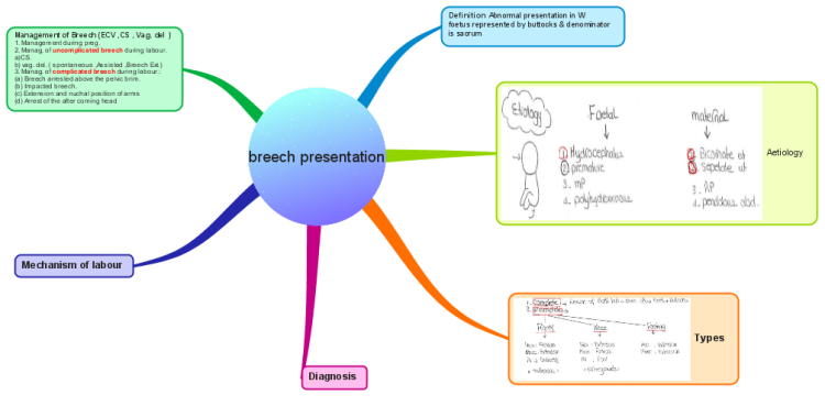 breech presentation 4